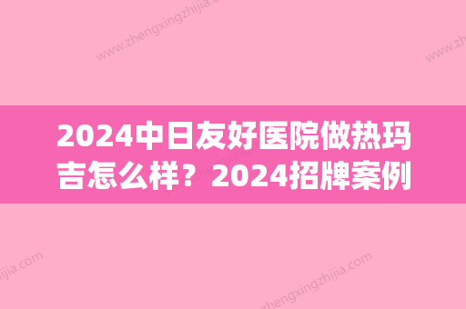 2024中日友好医院做热玛吉怎么样？2024招牌案例公开(中日友好医院热玛吉 多少钱)