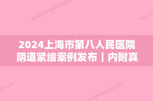 2024上海市第八人民医院阴道紧缩案例发布｜内附真人体验感悟