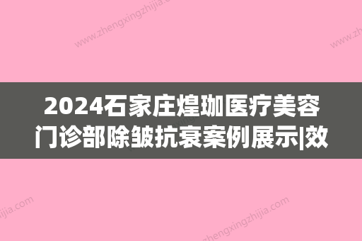 2024石家庄煌珈医疗美容门诊部除皱抗衰案例展示|效果自然美观