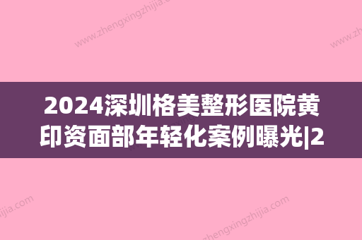 2024深圳格美整形医院黄印资面部年轻化案例曝光|2024体验感悟一览