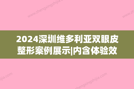 2024深圳维多利亚双眼皮整形案例展示|内含体验效果图(深圳推荐双眼皮手术)