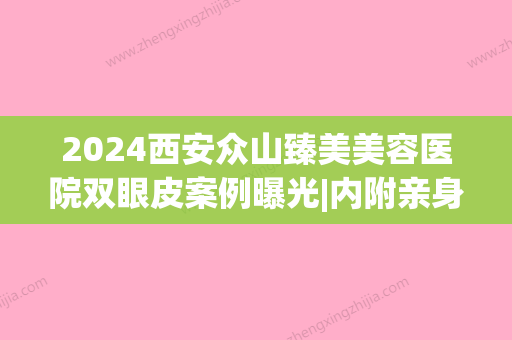 2024西安众山臻美美容医院双眼皮案例曝光|内附亲身体验效果图