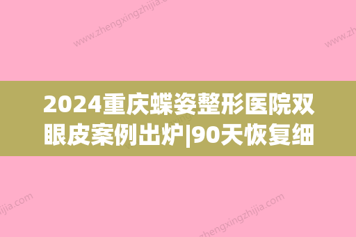 2024重庆蝶姿整形医院双眼皮案例出炉|90天恢复细节一览(重庆无痕双眼皮手术)