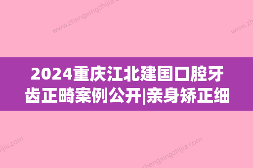 2024重庆江北建国口腔牙齿正畸案例公开|亲身矫正细节图分享