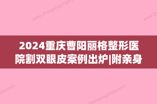 2024重庆曹阳丽格整形医院割双眼皮案例出炉|附亲身体验感悟(曹阳丽格医院双眼皮怎么样)