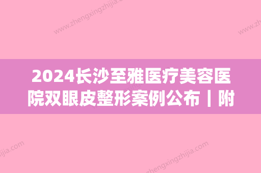 2024长沙至雅医疗美容医院双眼皮整形案例公布｜附体验效果图(长沙雅美做双眼皮怎么样)