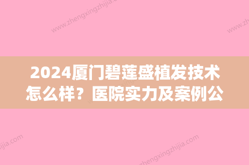 2024厦门碧莲盛植发技术怎么样？医院实力及案例公布(碧盛莲植发医院好不好)