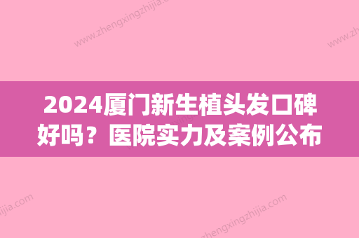 2024厦门新生植头发口碑好吗？医院实力及案例公布(厦门第一医院植发好吗)