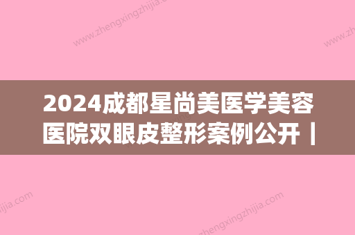 2024成都星尚美医学美容医院双眼皮整形案例公开｜附体验细节图(成都艺星割双眼皮怎么样)