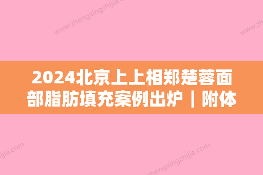 2024北京上上相郑楚蓉面部脂肪填充案例出炉｜附体验对比图