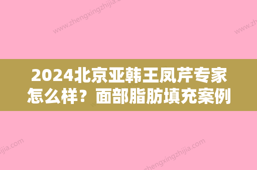 2024北京亚韩王凤芹专家怎么样？面部脂肪填充案例及效果图展示