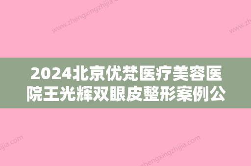 2024北京优梵医疗美容医院王光辉双眼皮整形案例公开｜附体验对比图