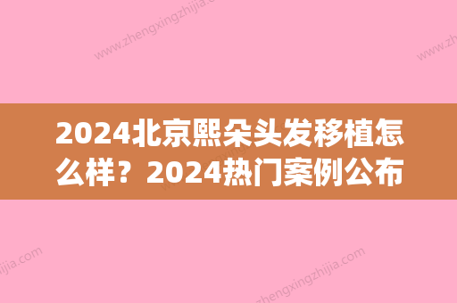 2024北京熙朵头发移植怎么样？2024热门案例公布(天津熙朵头发移植怎么样)