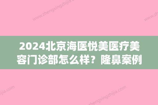 2024北京海医悦美医疗美容门诊部怎么样？隆鼻案例及效果图分享(海医悦美医疗美容官网)