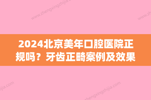 2024北京美年口腔医院正规吗？牙齿正畸案例及效果图分享(美年美口腔医院)