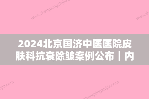 2024北京国济中医医院皮肤科抗衰除皱案例公布｜内附体验对比图