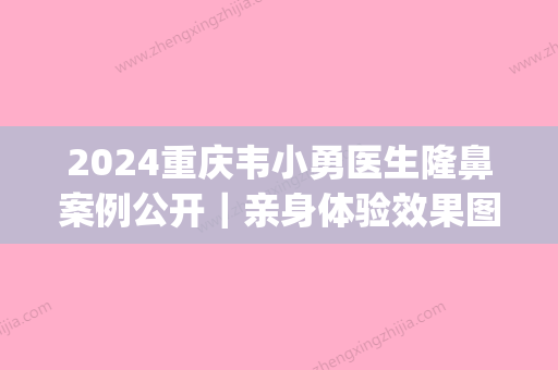 2024重庆韦小勇医生隆鼻案例公开｜亲身体验效果图集中一览(重庆医院隆鼻)