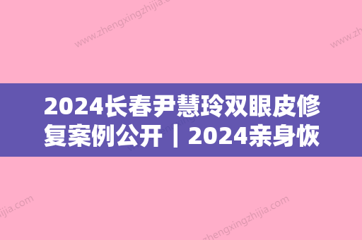 2024长春尹慧玲双眼皮修复案例公开｜2024亲身恢复效果图集中一览