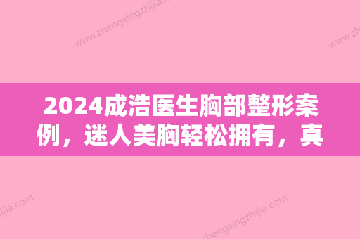 2024成浩医生胸部整形案例，迷人美胸轻松拥有，真人分享