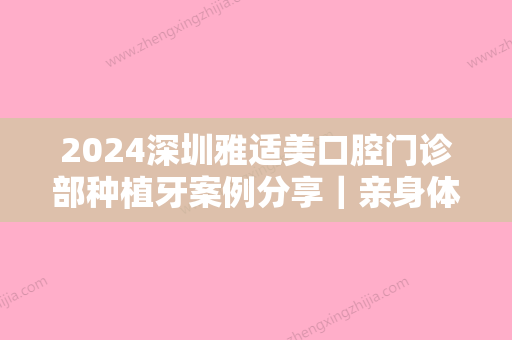 2024深圳雅适美口腔门诊部种植牙案例分享｜亲身体验感受一览