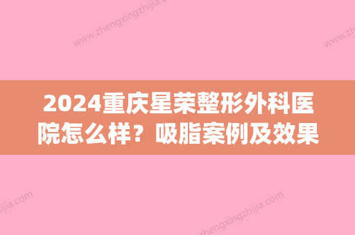 2024重庆星荣整形外科医院怎么样？吸脂案例及效果图公布(重庆手术吸脂)