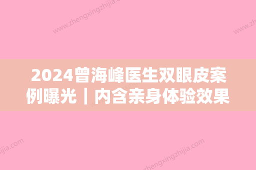 2024曾海峰医生双眼皮案例曝光｜内含亲身体验效果图