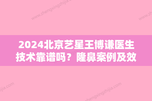 2024北京艺星王博谦医生技术靠谱吗？隆鼻案例及效果图一览