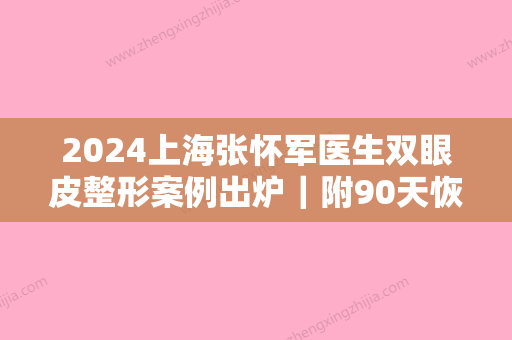 2024上海张怀军医生双眼皮整形案例出炉｜附90天恢复细节图