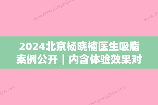 2024北京杨晓楠医生吸脂案例公开｜内含体验效果对比图