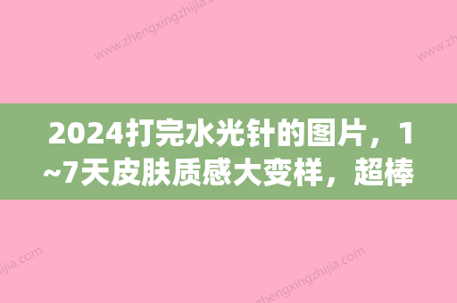 2024打完水光针的图片，1~7天皮肤质感大变样	，超棒(打完水光针3天后的图片对比)