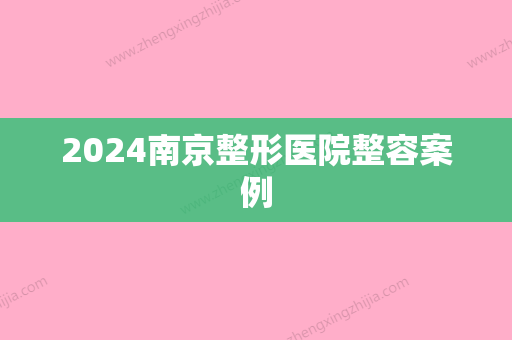 2024南京整形医院整容案例