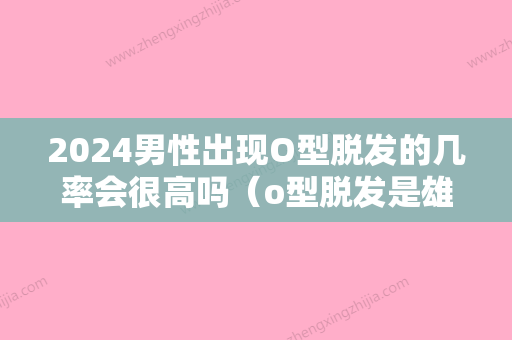 2024男性出现O型脱发的几率会很高吗（o型脱发是雄脱吗）