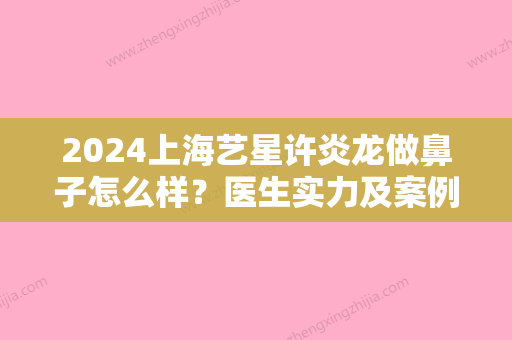 2024上海艺星许炎龙做鼻子怎么样？医生实力及案例展示