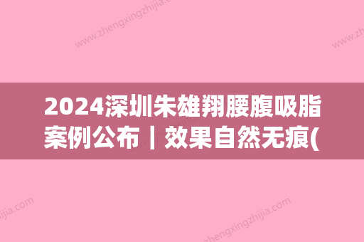 2024深圳朱雄翔腰腹吸脂案例公布｜效果自然无痕(深圳抽脂腹部)