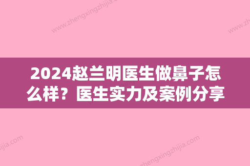 2024赵兰明医生做鼻子怎么样？医生实力及案例分享