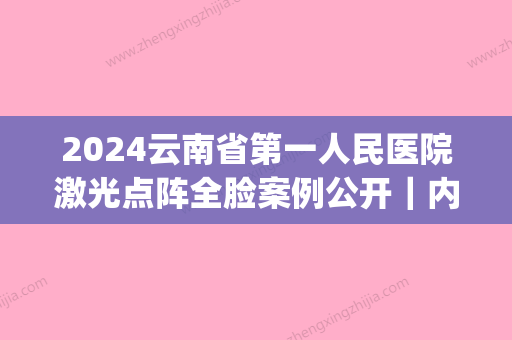 2024云南省第一人民医院激光点阵全脸案例公开｜内附体验效果图(昆明市第一人民医院点阵激光)