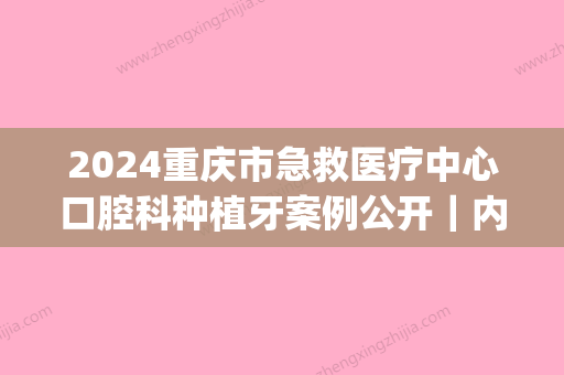 2024重庆市急救医疗中心口腔科种植牙案例公开｜内附体验对比图(重庆牙齿种植医院)