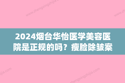 2024烟台华怡医学美容医院是正规的吗？瘦脸除皱案例及效果图展示(烟台华怡医学美容整形医院官网)