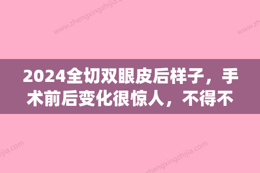 2024全切双眼皮后样子，手术前后变化很惊人，不得不看(全切双眼皮2年后变内双)