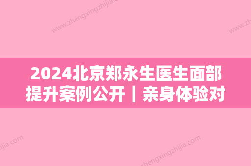 2024北京郑永生医生面部提升案例公开｜亲身体验对比图分享