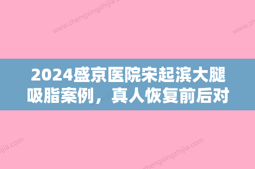 2024盛京医院宋起滨大腿吸脂案例，真人恢复前后对比照片更新