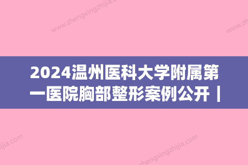 2024温州医科大学附属第一医院胸部整形案例公开｜附体验效果图(温州第一人民医院整形科)