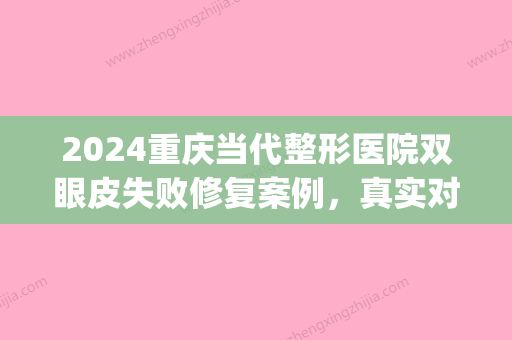 2024重庆当代整形医院双眼皮失败修复案例，真实对比图片展示(重庆割双眼皮的失败重庆当代可以吗?)