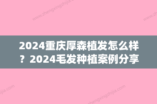 2024重庆厚森植发怎么样？2024毛发种植案例分享(重庆来森植发)