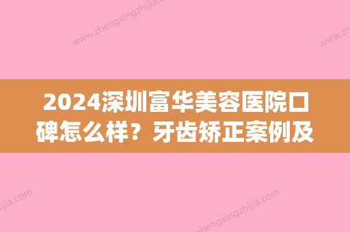 2024深圳富华美容医院口碑怎么样？牙齿矫正案例及效果图公布(深圳富华整形美容医院)