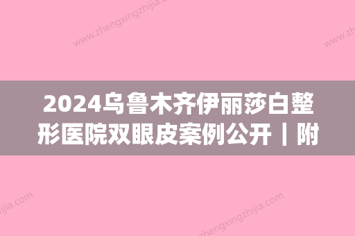 2024乌鲁木齐伊丽莎白整形医院双眼皮案例公开｜附90天恢复细节图(乌鲁木齐公立医院割双眼皮)