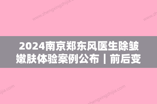 2024南京郑东风医生除皱嫩肤体验案例公布｜前后变化巨大