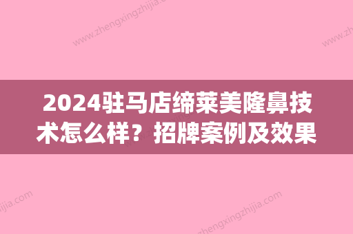 2024驻马店缔莱美隆鼻技术怎么样？招牌案例及效果图分享(驻马店缔莱美整形医院好不好)