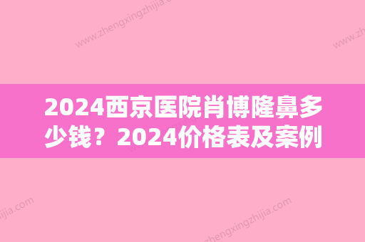 2024西京医院肖博隆鼻多少钱？2024价格表及案例一览