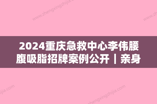 2024重庆急救中心李伟腰腹吸脂招牌案例公开｜亲身体验前后对比图一览